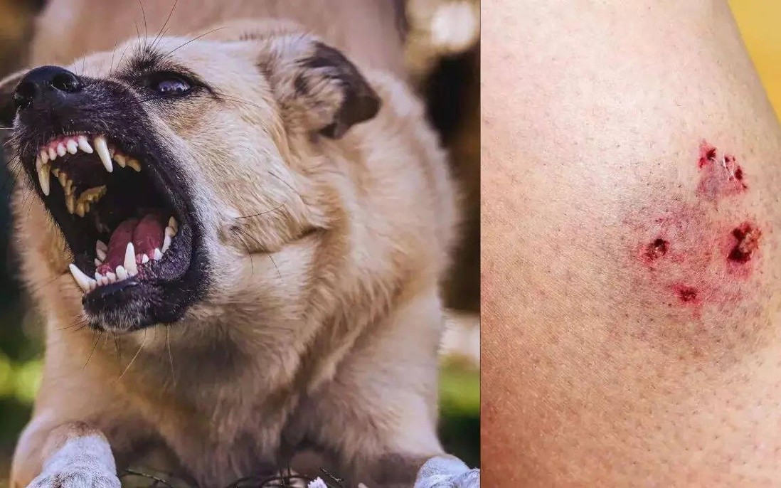 tai sao cho dai sau khi can nguoi lai chet 69217fe74ed50